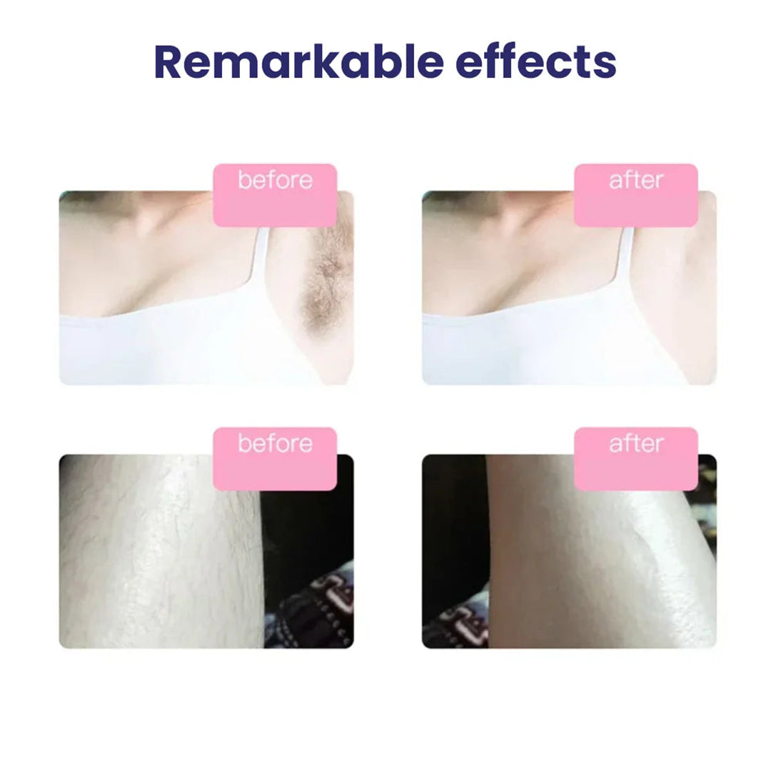 IPL Laser Hair Removal Machine