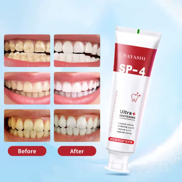 SP-4 Ultra+ Probiotic Whitening Toothpaste